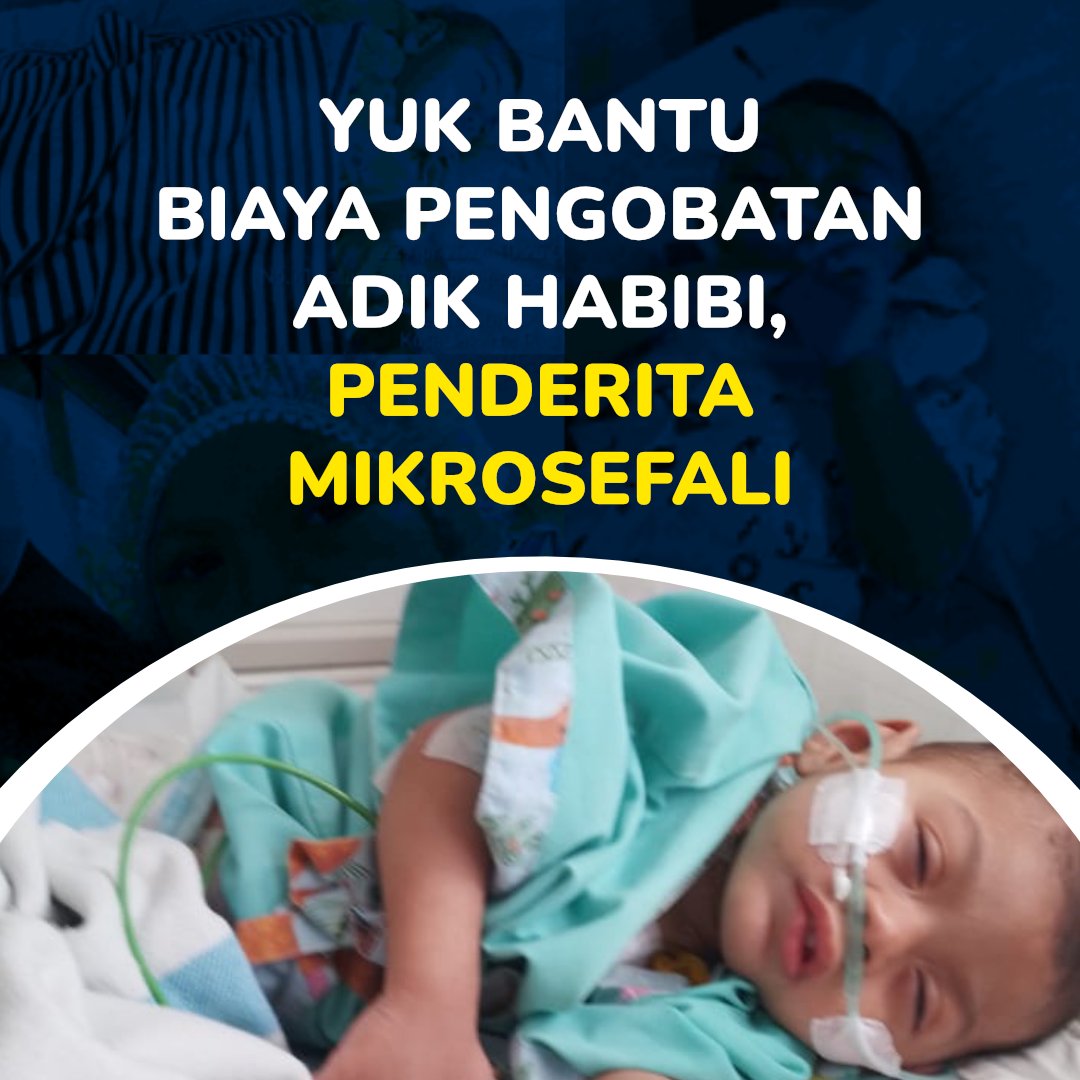 Bantu Pengobatan Habibi, Penderita Mikrosefali